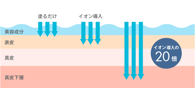 ケアシスS(エレクトロポレーション)の特徴